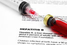 Особенности алкогольного гепатита у взрослых, причины и механизм развития, опасность и течение
